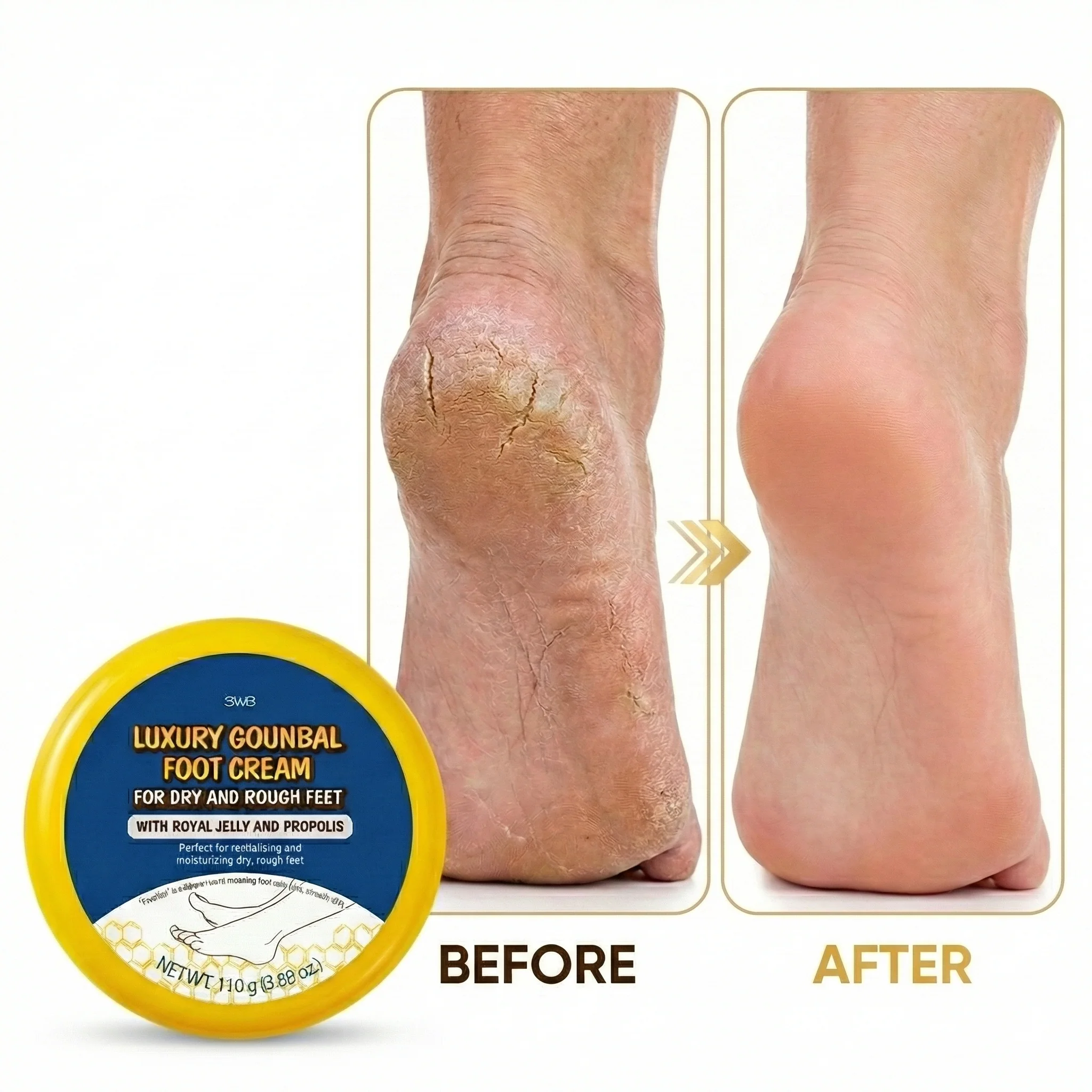 3WB Luxury Foot Cream – Intensive Urea & Propolis Repair for Cracked Heels, Dry Calluses, and Peeling Skin