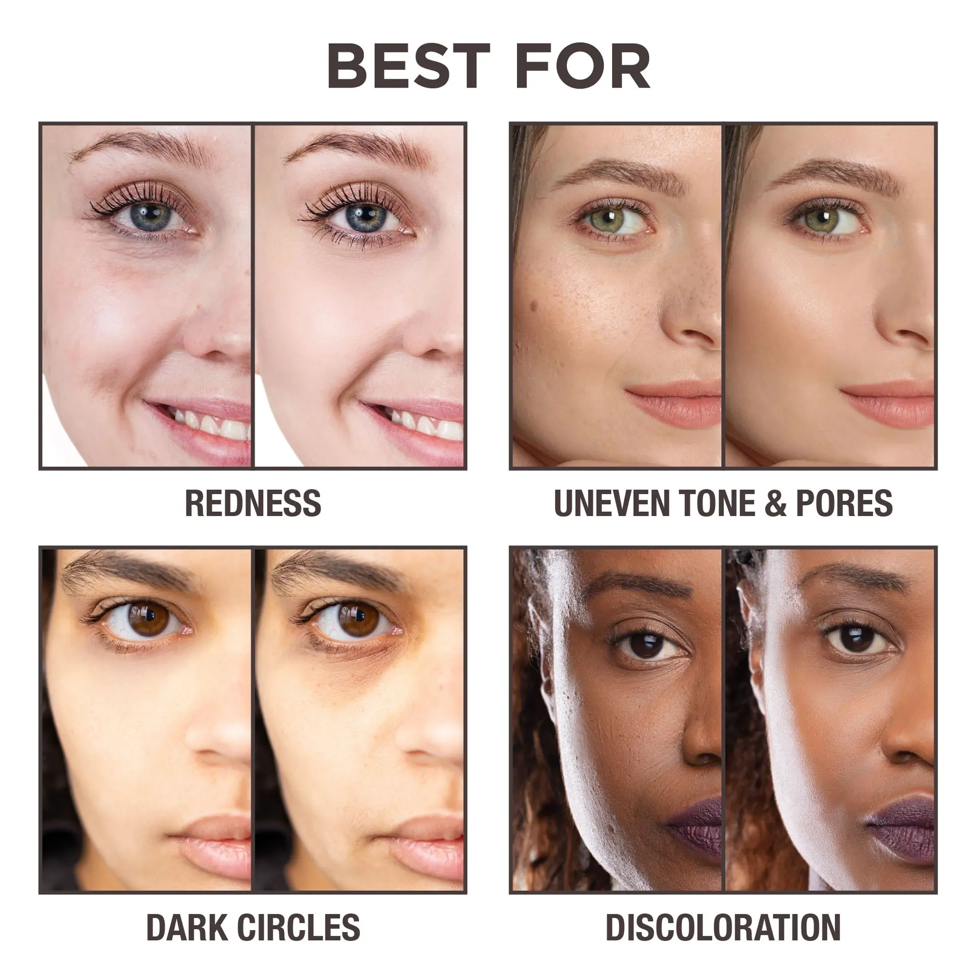 Ivy Beauty Full Coverage Under Eye Concealer for Dark Circles, Redness & Blemishes - Image 88
