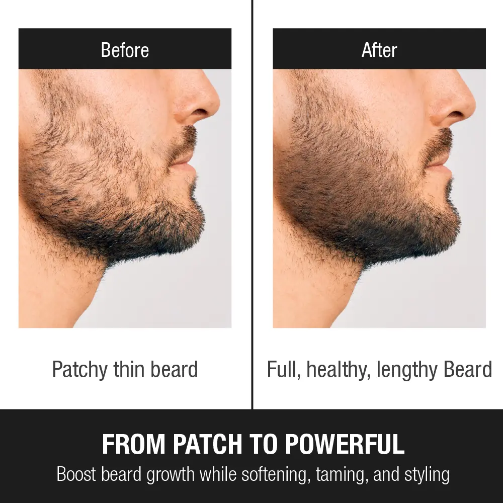 RED by KISS Groomane Beard Oil for Growth – Biotin & Argan Infused - Image 3