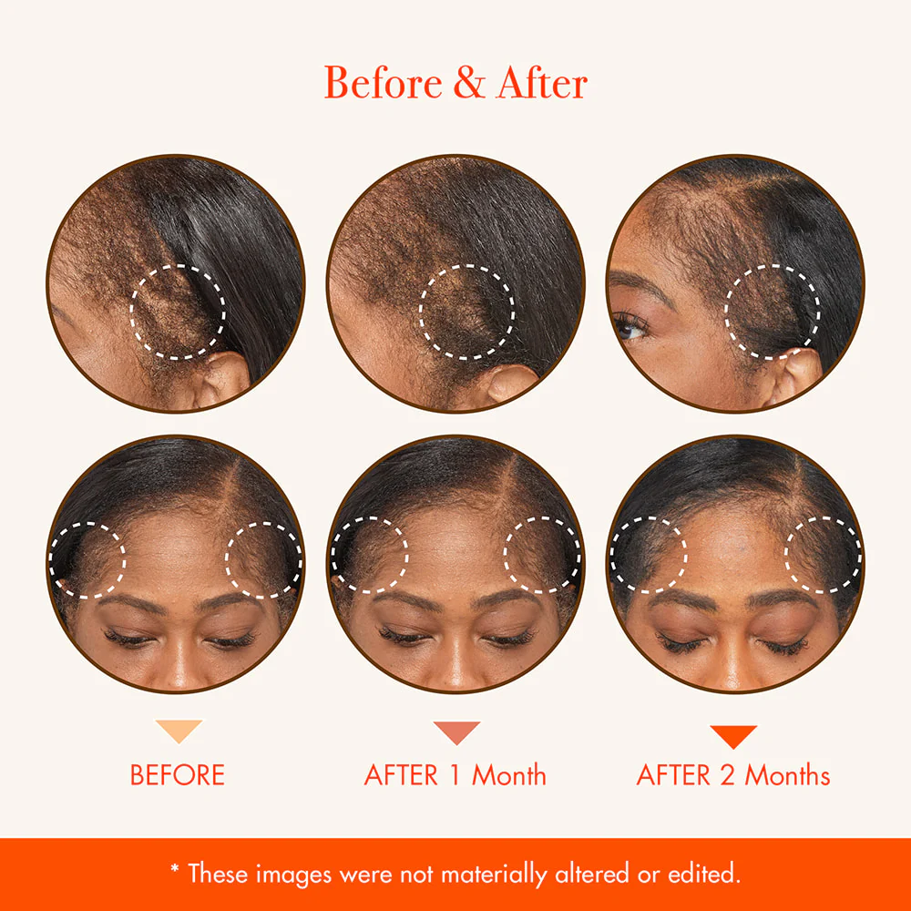 RED by KISS Growth MD Scalp Serum Biotin, Niacinamide, Panthenol, Rosemary Oil Infused - Image 6