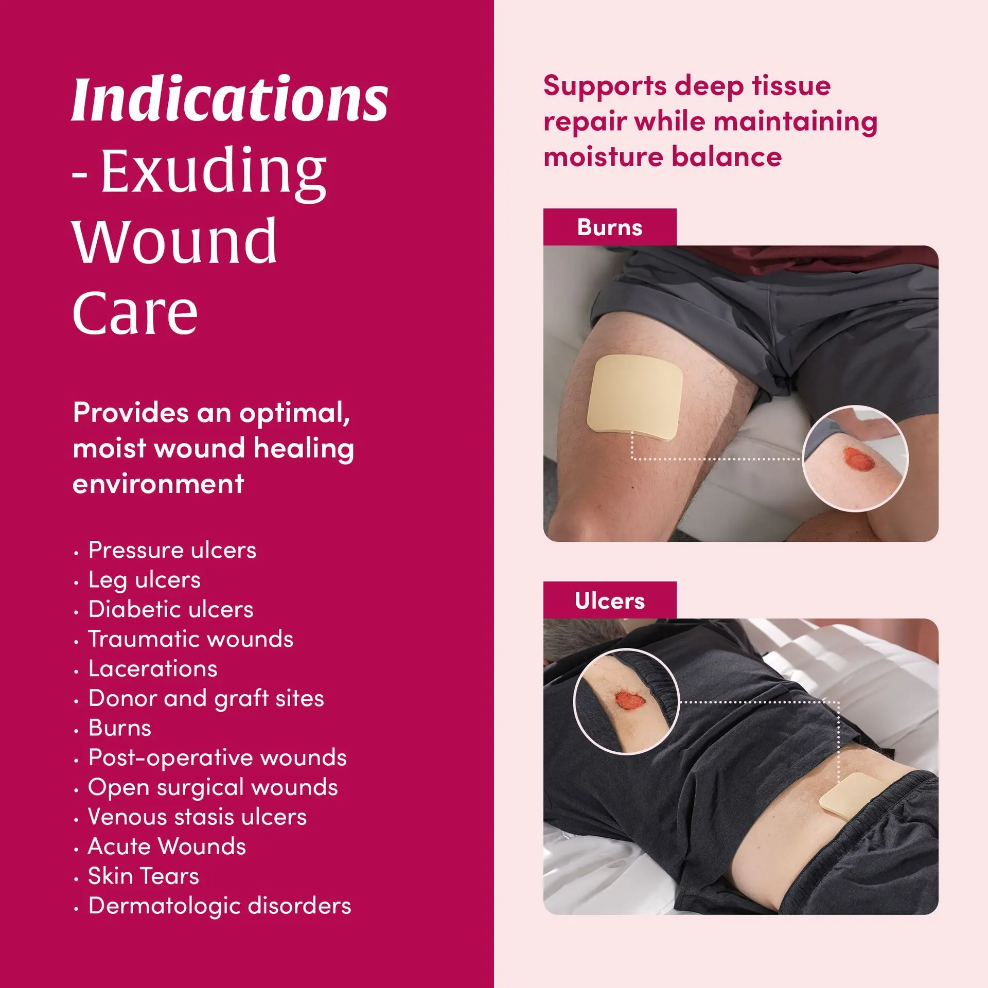 Medifoam Self-Adhesive Hydrocolloid Wound Dressing Pads - Image 14